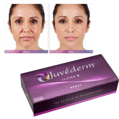 اسيد هايالورونيک ژل پر کننده صورت Juvederm پوست صاف و بدون نقص