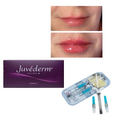 6 تا 9 ماه طول عمر ژل پرکننده پوست Juvederm برای خرید آنلاین و در فروشگاه
