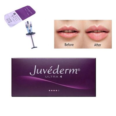 آلرگان ژوودرم پرکننده پوست تزریق Ultra4 با Lido