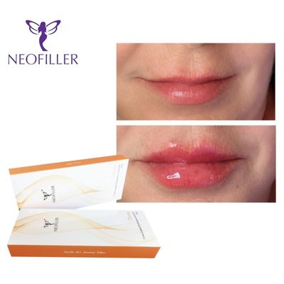 24mg-ml 2ml سرنج پوست اسید هیالورونیک پرکننده پوست ژل تزریقی تقویت جوان سازی صورت