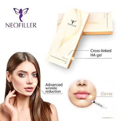 Neofiller 2 سال عمر شیلف اسید هیالورونیک پرکننده پوست آسان عمل ژل تزریقی افزایش شکل صورت