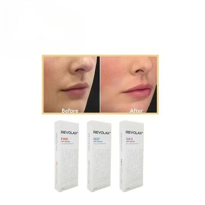 فیلر پوستی Revolax Fine Deep Sub-Q با ژل صاف و الاستیک برای بازسازی حجم طبیعی صورت