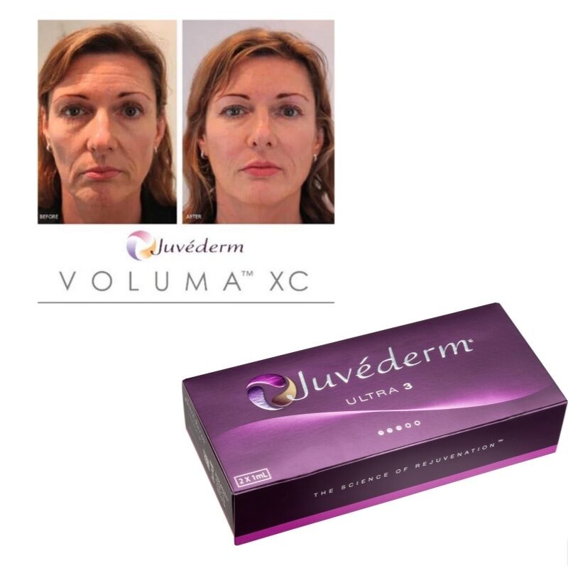 اصلاح چین و چروک Juvederm پرکننده پوستی اسید هیالورونیک ژل تزریقی درمان صاف کننده طولانی مدت
