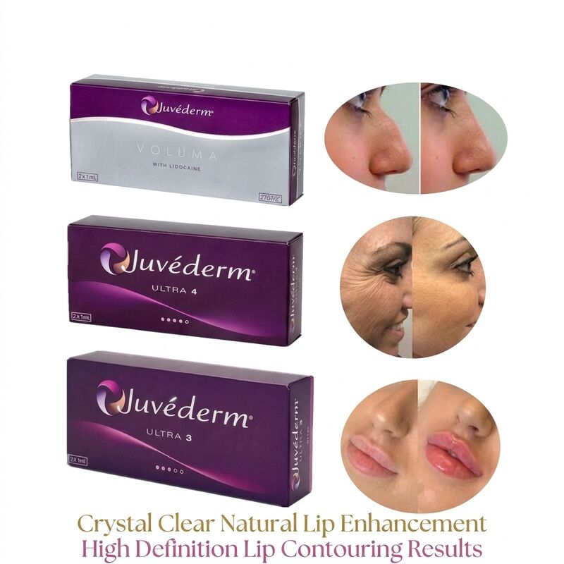 حجم سرنگ 2 1 میلی لیتر در هر جعبه Juvederm Voluma Filler Safety Facial Contouring فیلر تزریقی تزریقی برای افزایش حجم