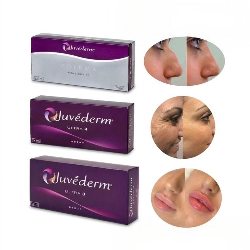24mg/ml Juvederm Lip Filler Juvederm Ultra3 Ultra4 حجم تزریقی